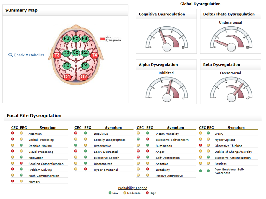 summary map of brain wave activity created for a patient during a brainmapping session