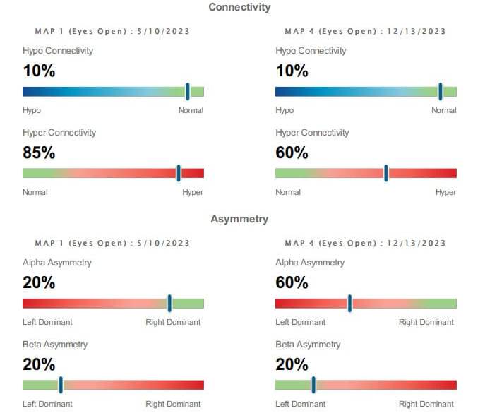 brainmap-qeeg-anxiety-7